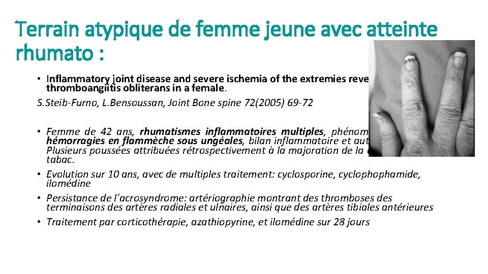 Terrain atypique de femme jeune avec atteinte rhumato : • Inflammatory joint disease and