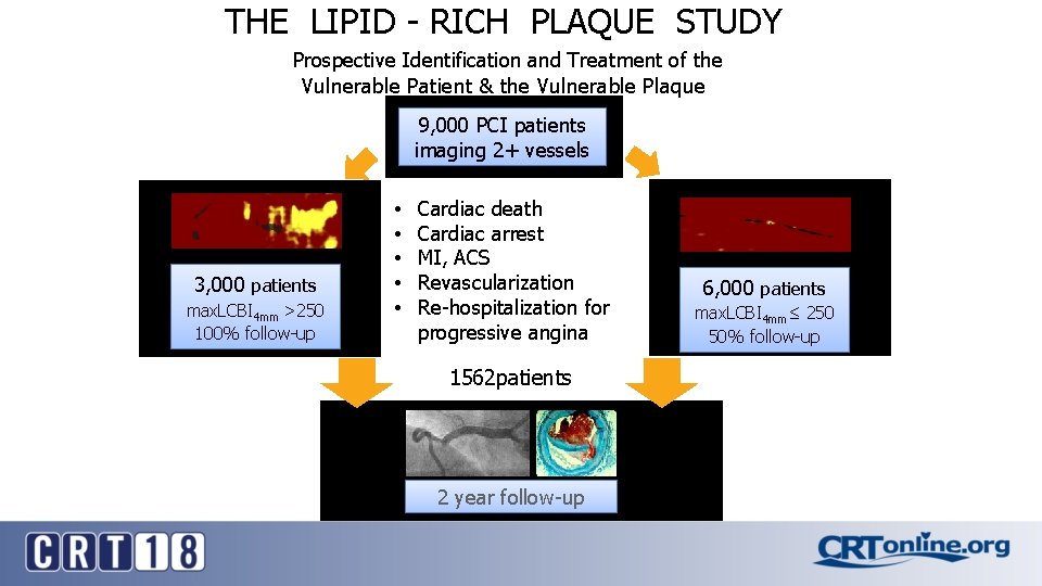 THE LIPID - RICH PLAQUE STUDY Prospective Identification and Treatment of the Vulnerable Patient