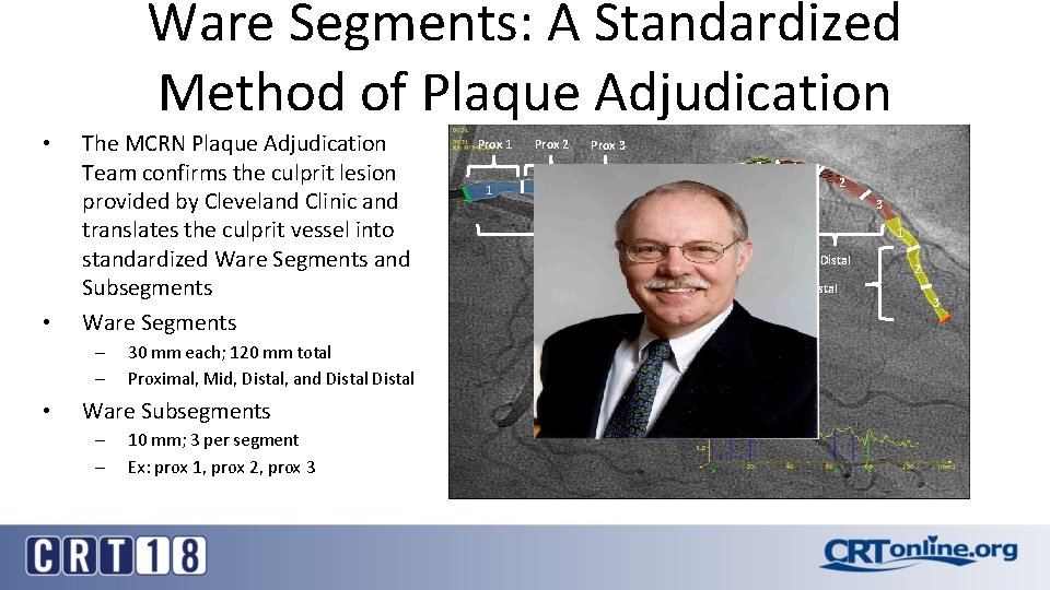 Ware Segments: A Standardized Method of Plaque Adjudication • • The MCRN Plaque Adjudication