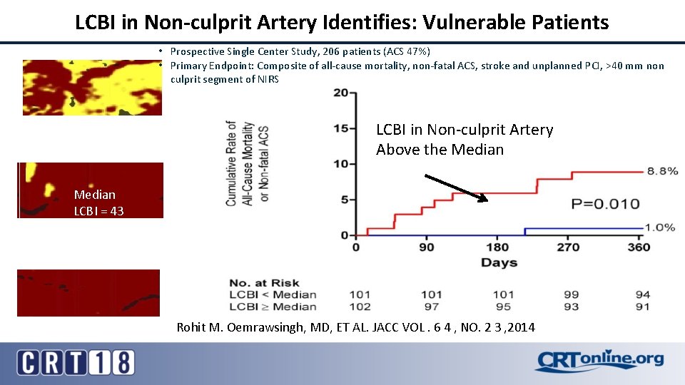 LCBI in Non-culprit Artery Identifies: Vulnerable Patients • Prospective Single Center Study, 206 patients