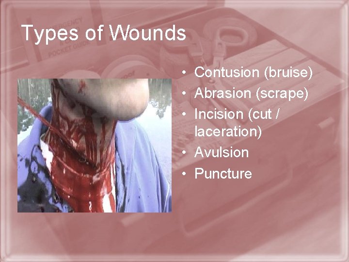 Types of Wounds • Contusion (bruise) • Abrasion (scrape) • Incision (cut / laceration)