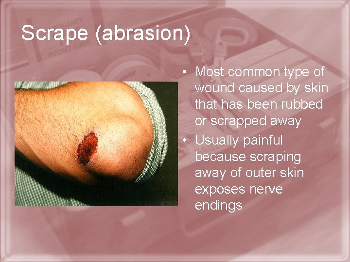 Scrape (abrasion) • Most common type of wound caused by skin that has been