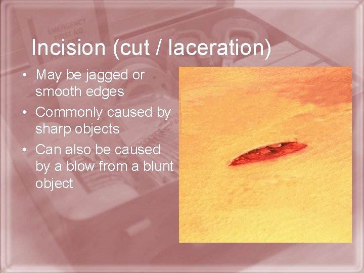 Incision (cut / laceration) • May be jagged or smooth edges • Commonly caused