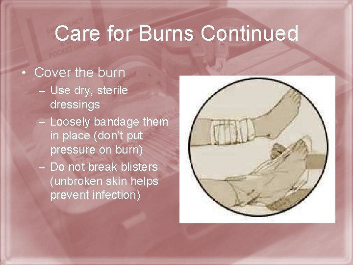 Care for Burns Continued • Cover the burn – Use dry, sterile dressings –
