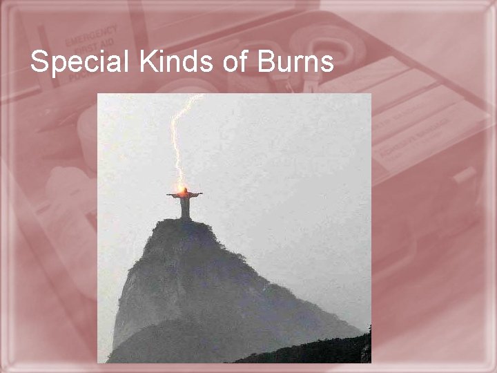Special Kinds of Burns 