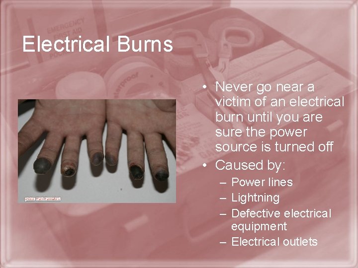 Electrical Burns • Never go near a victim of an electrical burn until you