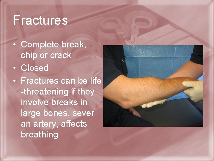 Fractures • Complete break, chip or crack • Closed • Fractures can be life