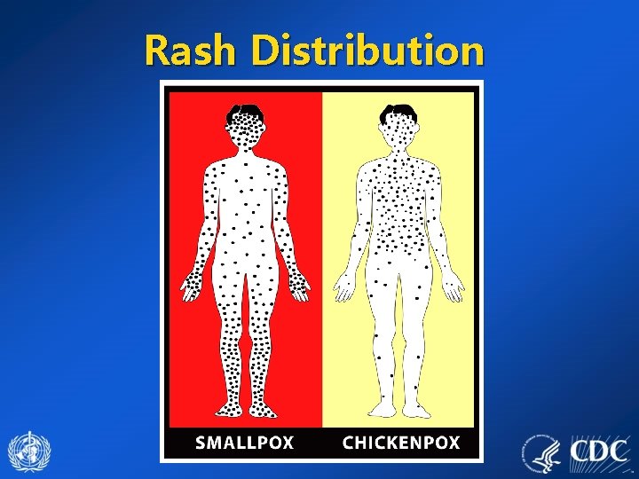 Rash Distribution 