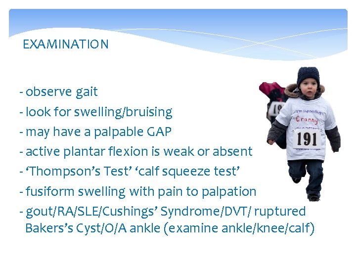 EXAMINATION - observe gait - look for swelling/bruising - may have a palpable GAP