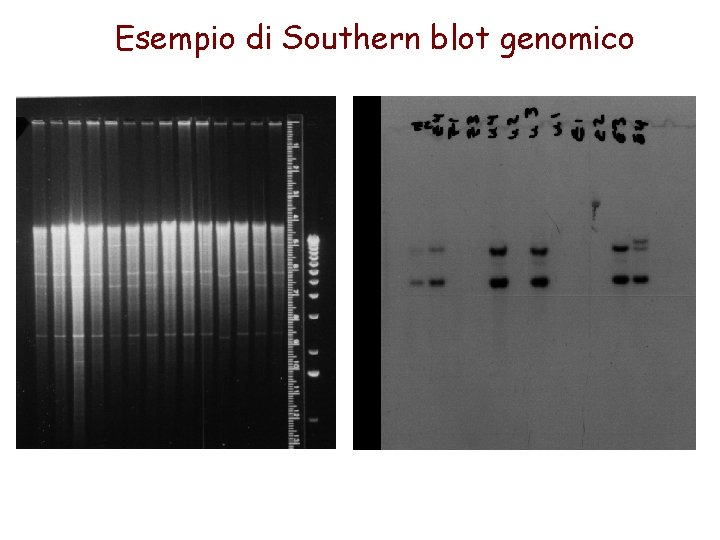 Esempio di Southern blot genomico 