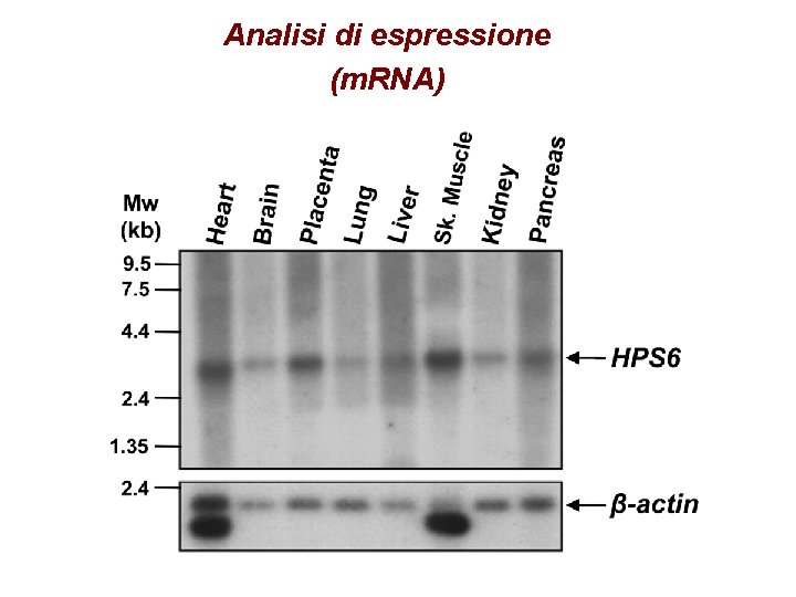 Analisi di espressione (m. RNA) 