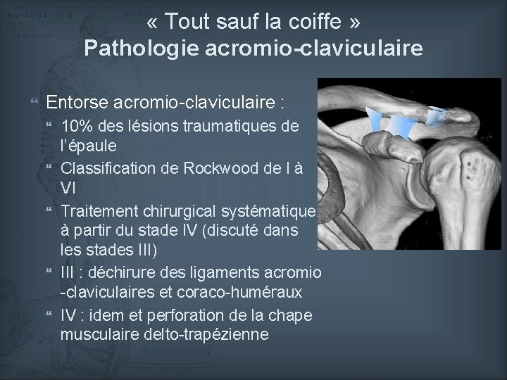  « Tout sauf la coiffe » Pathologie acromio-claviculaire Entorse acromio-claviculaire : 10% des