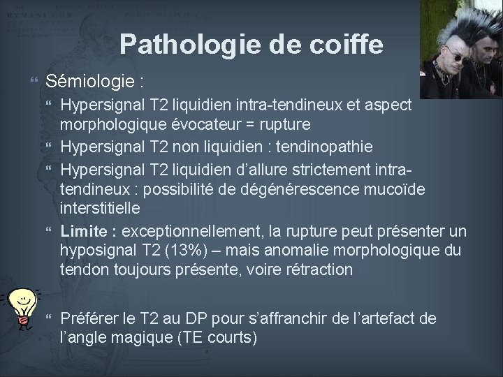 Pathologie de coiffe Sémiologie : Hypersignal T 2 liquidien intra-tendineux et aspect morphologique évocateur