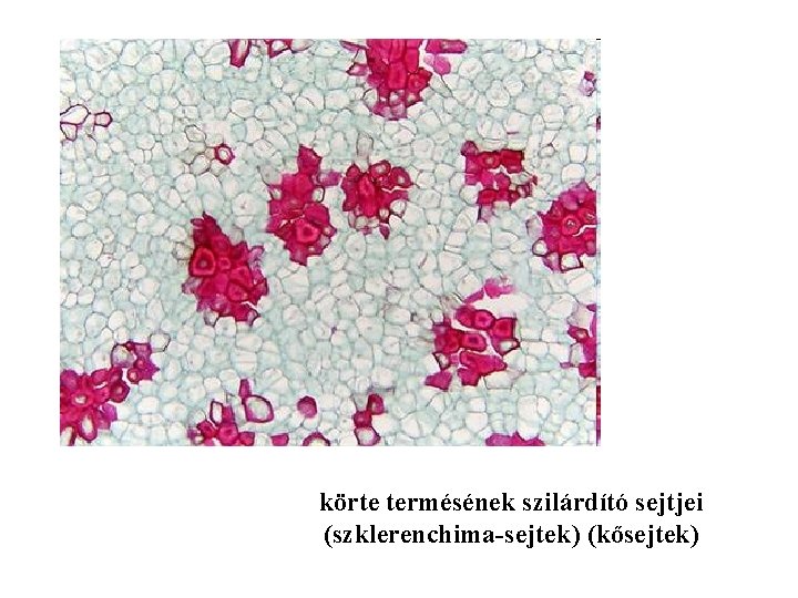 körte termésének szilárdító sejtjei (szklerenchima-sejtek) (kősejtek) 