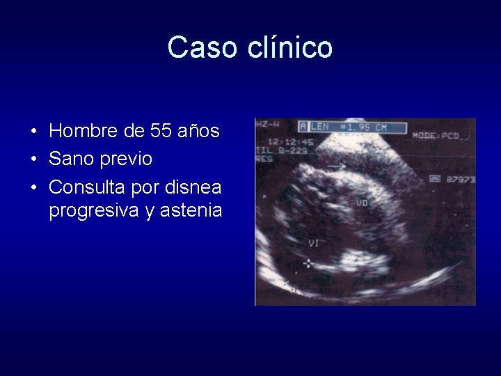Caso clínico • Hombre de 55 años • Sano previo • Consulta por disnea