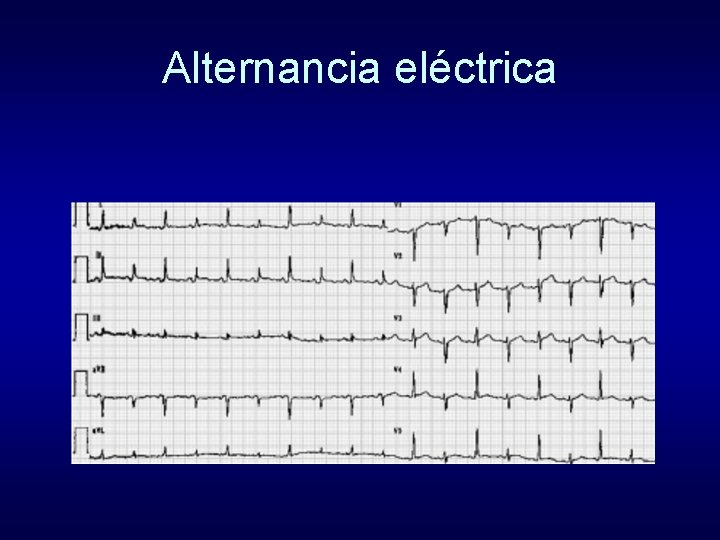Alternancia eléctrica 