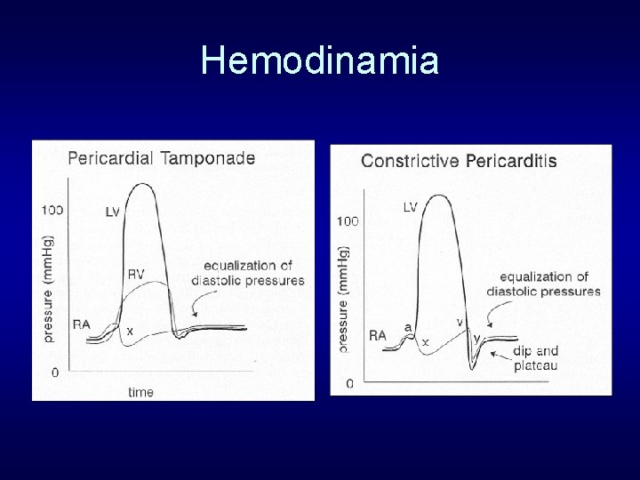 Hemodinamia 