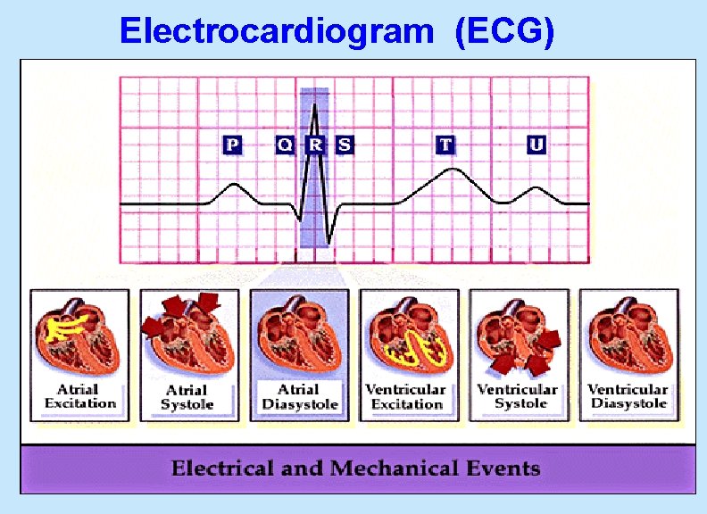 Electrocardiogram (ECG) 