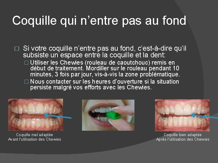 Coquille qui n’entre pas au fond � Si votre coquille n’entre pas au fond,