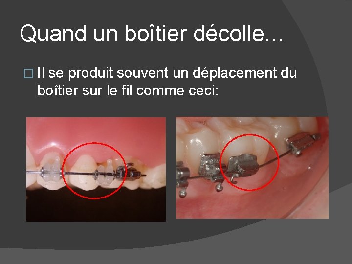 Quand un boîtier décolle… � Il se produit souvent un déplacement du boîtier sur