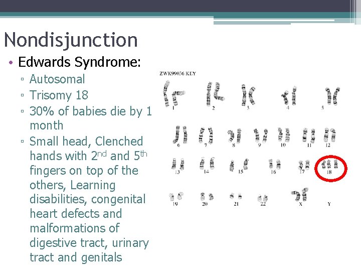 Nondisjunction • Edwards Syndrome: ▫ Autosomal ▫ Trisomy 18 ▫ 30% of babies die
