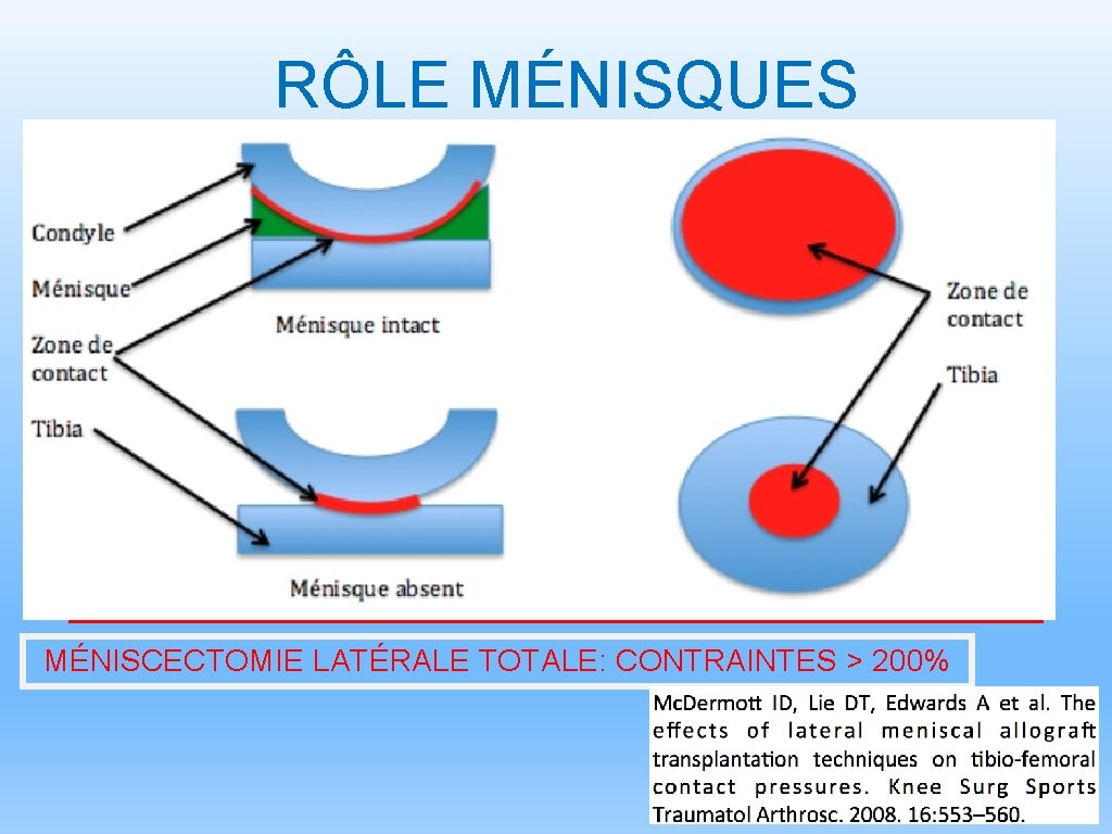 RÔLE MÉNISQUES • Propriétés mécaniques+++ • Augmentent surface de contact: congruence - ME: fonction: