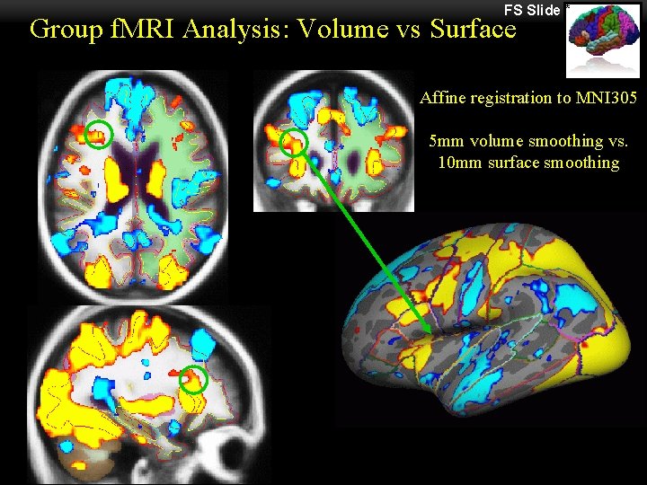 FS Slide * Group f. MRI Analysis: Volume vs Surface Affine registration to MNI