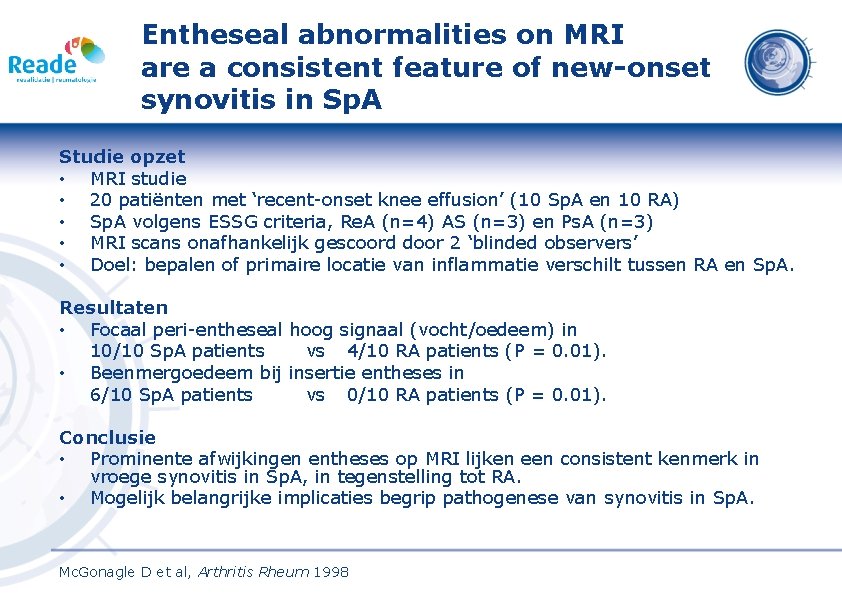 Entheseal abnormalities on MRI are a consistent feature of new-onset synovitis in Sp. A
