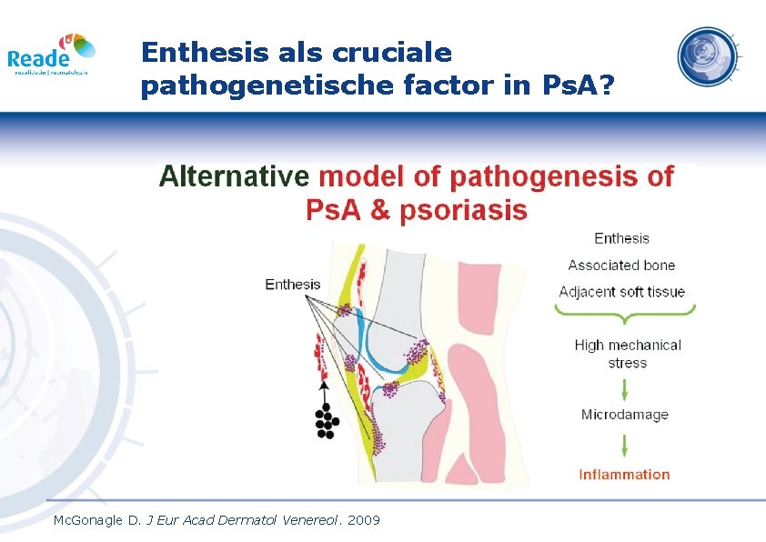 Enthesis als cruciale pathogenetische factor in Ps. A? Mc. Gonagle D. J Eur Acad
