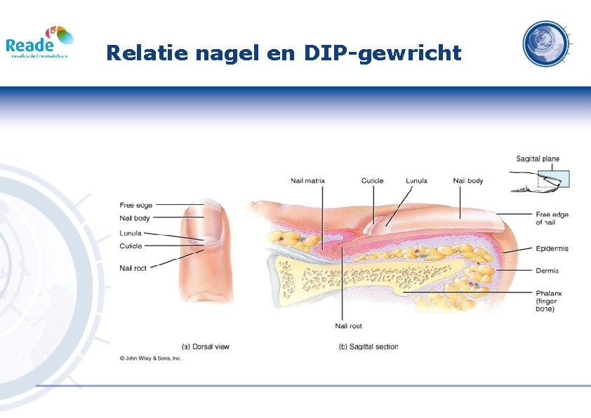 Relatie nagel en DIP-gewricht 