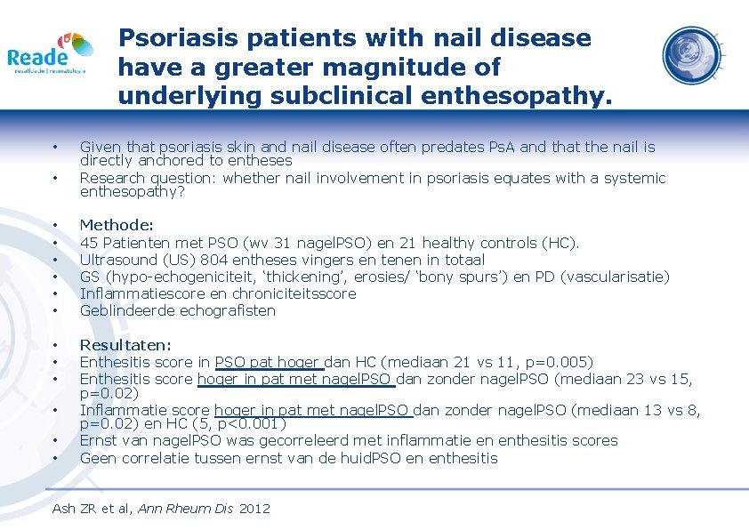 Psoriasis patients with nail disease have a greater magnitude of underlying subclinical enthesopathy. •