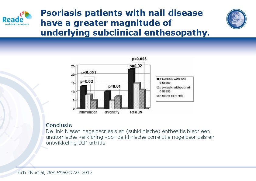 Psoriasis patients with nail disease have a greater magnitude of underlying subclinical enthesopathy. Conclusie