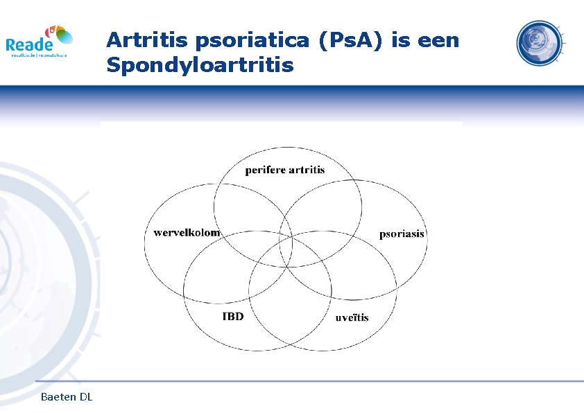 Artritis psoriatica (Ps. A) is een Spondyloartritis Baeten DL 