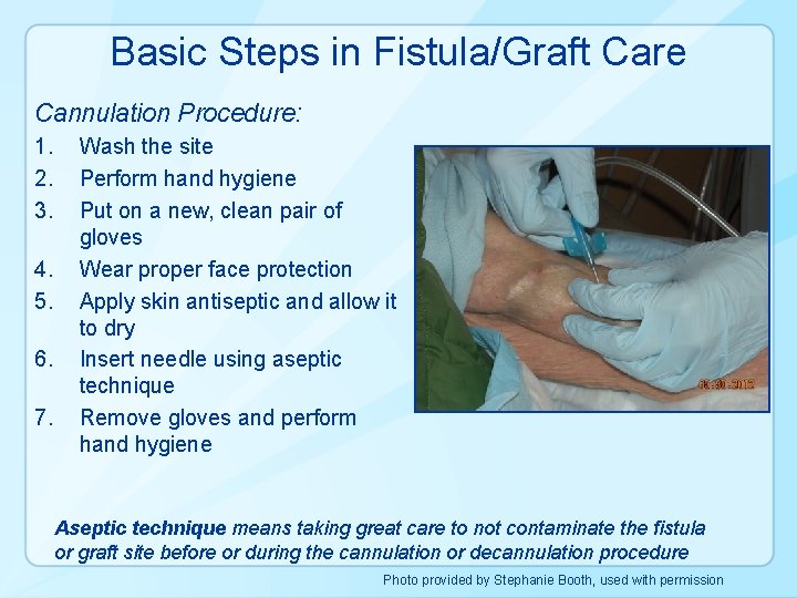 Basic Steps in Fistula/Graft Care Cannulation Procedure: 1. 2. 3. 4. 5. 6. 7.