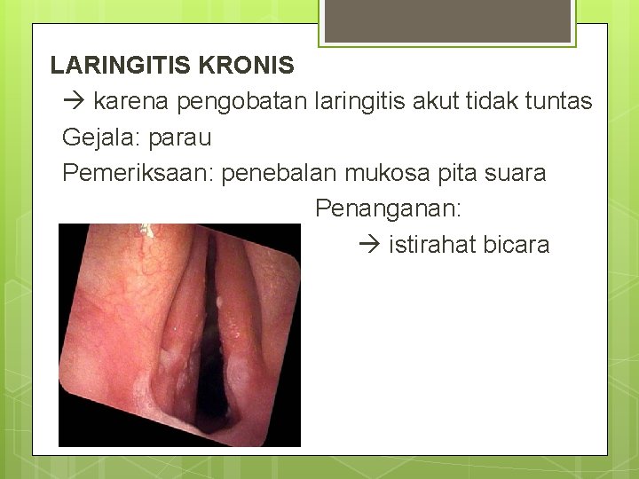 LARINGITIS KRONIS karena pengobatan laringitis akut tidak tuntas Gejala: parau Pemeriksaan: penebalan mukosa pita LARINGITIS KRONIS karena pengobatan laringitis akut tidak tuntas Gejala: parau Pemeriksaan: penebalan mukosa pita