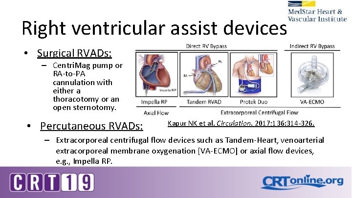 Right ventricular assist devices • Surgical RVADs: – Centri. Mag pump or RA-to-PA cannulation Right ventricular assist devices • Surgical RVADs: – Centri. Mag pump or RA-to-PA cannulation