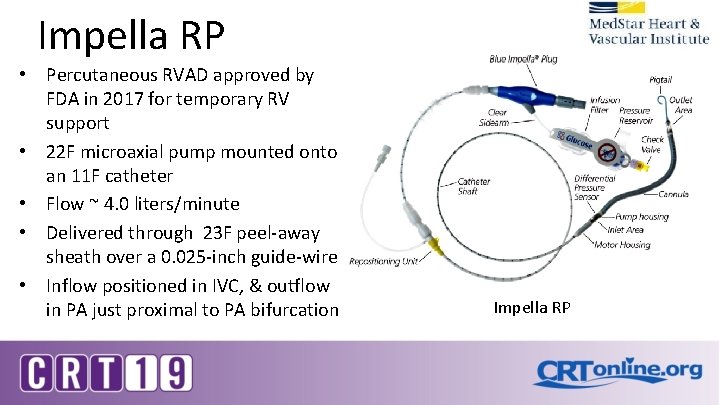 Impella RP • Percutaneous RVAD approved by FDA in 2017 for temporary RV support Impella RP • Percutaneous RVAD approved by FDA in 2017 for temporary RV support