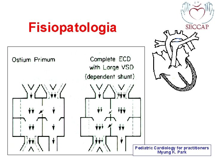 Fisiopatologia Pediatric Cardiology for practitioners Myung K. Park 