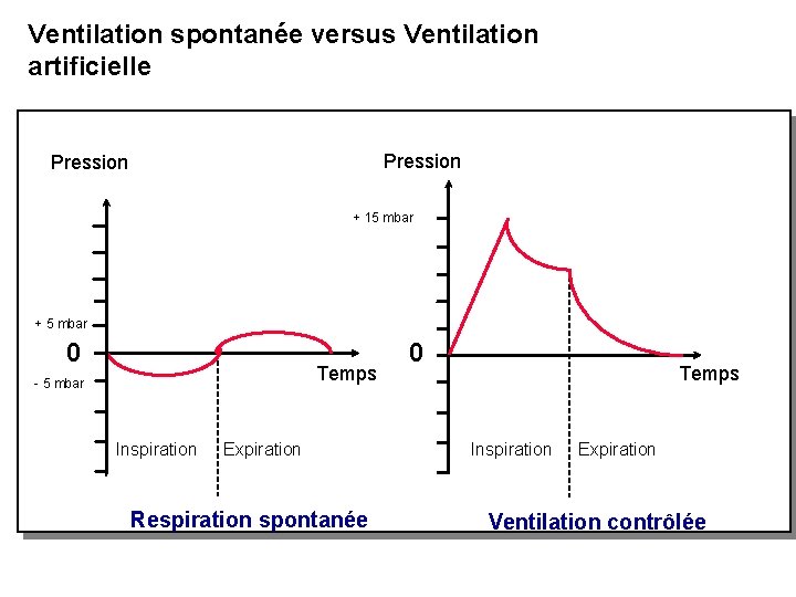 Ventilation spontanée versus Ventilation artificielle Pression + 15 mbar + 5 mbar 0 Temps