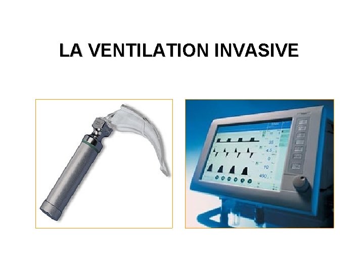 LA VENTILATION INVASIVE 