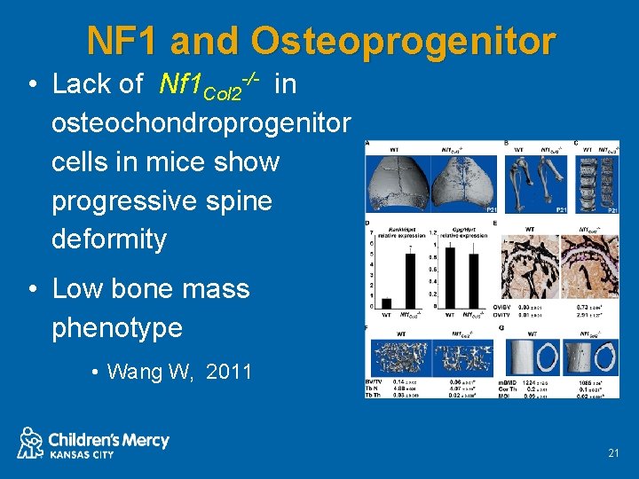 NF 1 and Osteoprogenitor • Lack of Nf 1 Col 2 -/- in osteochondroprogenitor