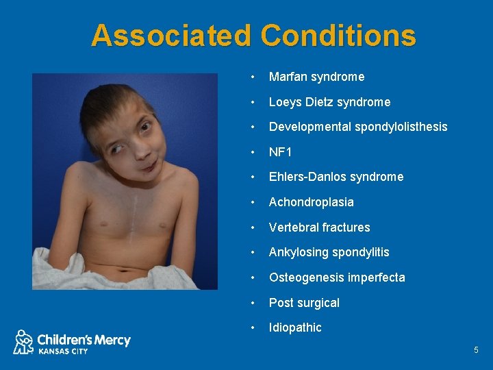Associated Conditions • Marfan syndrome • Loeys Dietz syndrome • Developmental spondylolisthesis • NF