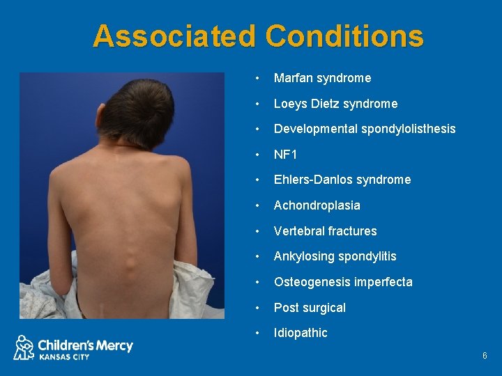 Associated Conditions • Marfan syndrome • Loeys Dietz syndrome • Developmental spondylolisthesis • NF