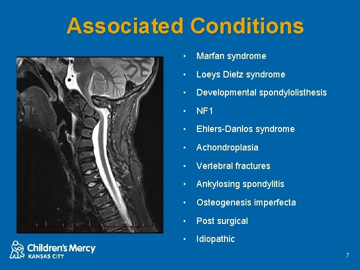 Associated Conditions • Marfan syndrome • Loeys Dietz syndrome • Developmental spondylolisthesis • NF