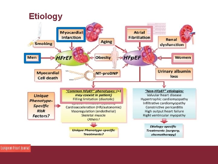 Etiology Congestive Heart Failure 26/11/2020 Pagina 16 