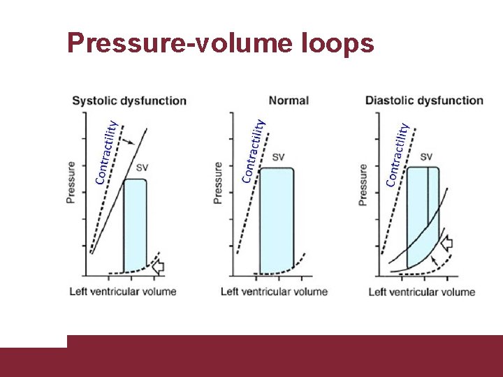 Pressure-volume loops Congestive Heart Failure 26/11/2020 Pagina 20 