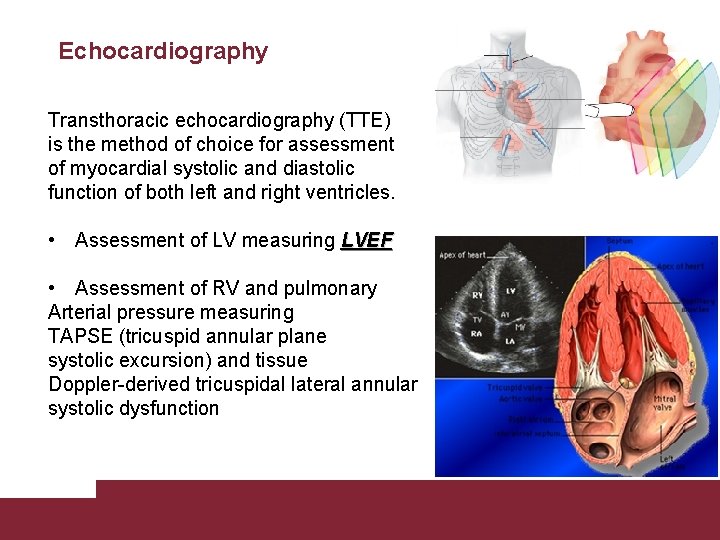 Echocardiography Transthoracic echocardiography (TTE) is the method of choice for assessment of myocardial systolic