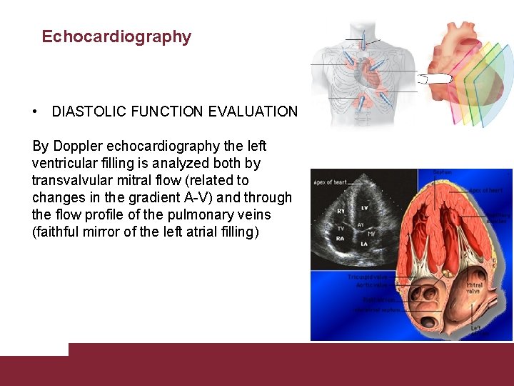 Echocardiography • DIASTOLIC FUNCTION EVALUATION By Doppler echocardiography the left ventricular filling is analyzed