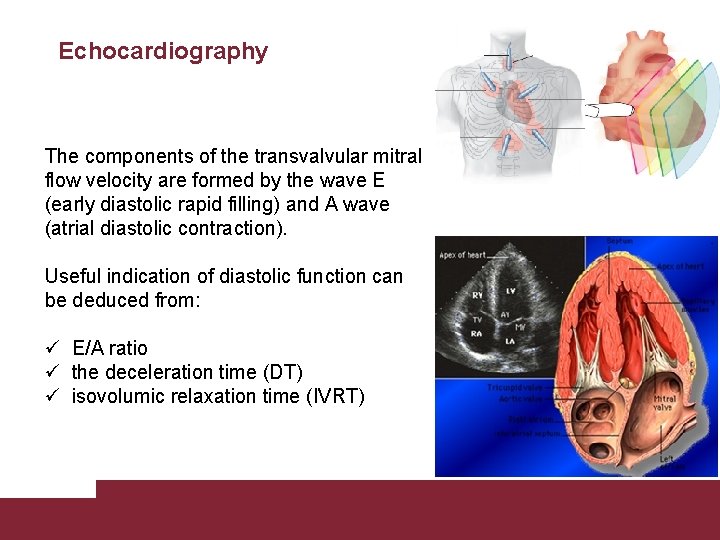 Echocardiography The components of the transvalvular mitral flow velocity are formed by the wave