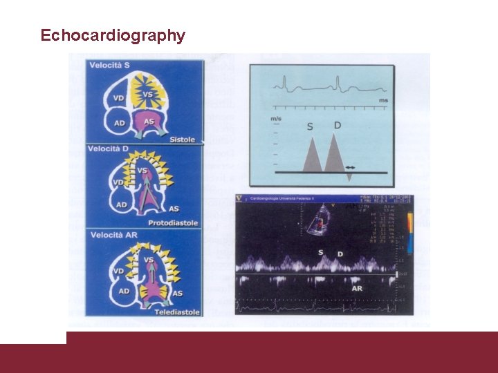 Echocardiography Congestive Heart Failure 26/11/2020 Pagina 30 